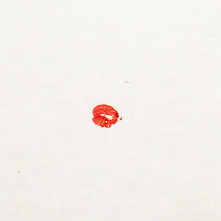 redmark – Catalyst